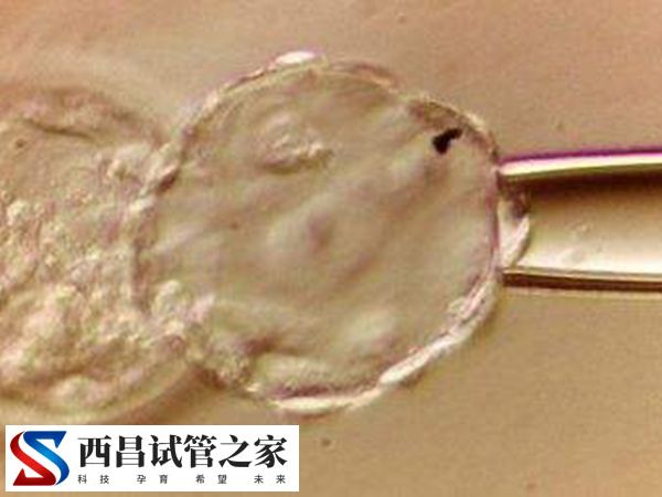 试管婴儿移植手术不能选择胎儿性别